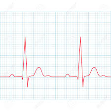 Medical Electrocardiogram Ecg On Grid Paper Graph Of Heart