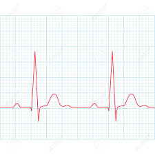 Medical Electrocardiogram Ecg On Grid Paper Graph Of Heart