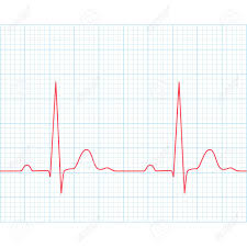 medical electrocardiogram ecg on grid paper graph of heart