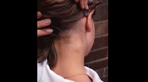 Swollen lymph node possibly throat cancer. Adenopathy Symptoms Causes Treatment And More
