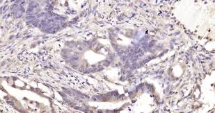 Inner chest cavity is lined by parietal pleural membrane. Pkc Delta Ser645 Polyclonal Antibody Bioss