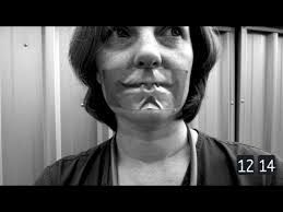 How a Crisis Resource Management failure led to a full-blown medical  emergency