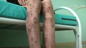 Resultado de imagem para Krokodil pictures
