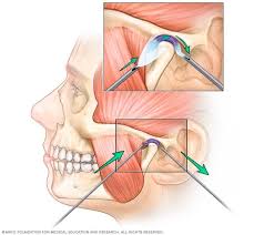 Pin On Health Tmj Tmd Disorder