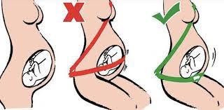 Posture In Pregnancy Do S Don Ts Reliva Physiotherapy Rehab