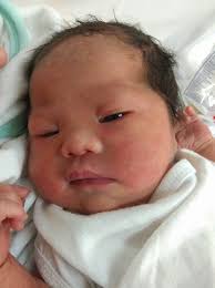 Good day mag ask lang sana if mukha po ba syang may down syndrome ? . If  ever saan po may malapit sa taguig na may 2d echo & karyotyping . Public