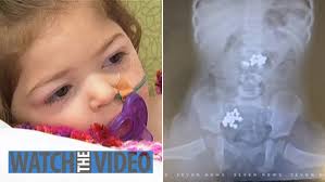 Girl, 18 months, almost died after swallowing 32 ball bearing magnets from  activity toy during lockdown