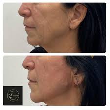 פרופיל של ‏ד"ר אורן גרינולד מרפאה לאסתטיקה רפואית‏‎