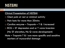 A myocardial infarction is the medical term for a heart attack. Ppt Treatment Of Chronic Stable Angina And Acute Coronary Syndrome Unstable Angina Nstemi Stemi Powerpoint Presentation Id 2224153