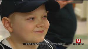 10-Year-Old Little Axe Burn Victim Walks Out Of Hospital After 8 Months Of  Recovery