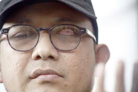 Novel baswedan lahir di semarang, 22 juni 1977 ini merupakan lulusan akademi kepolisisan tahun 1998. Penyerang Novel Baswedan Dua Anggota Polisi Aktif Ditangkap Bbc News Indonesia