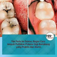 Pasta Gigi Pembersih Karang Gigi Home Facebook