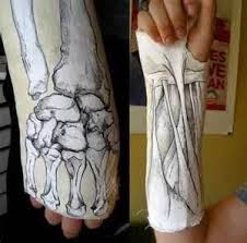 Arm Cast Art Arm Cast Cast Art It Cast
