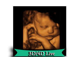 Will medicaid pay for a 3d ultrasound? Services And Prices Affordable 3d 4d Ultrasound In Houston Texas