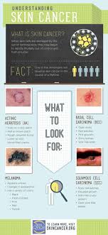 Here are 10 more facts about prostate cancer. Understanding Skin Cancer Infographic Msd Manual Professional Edition