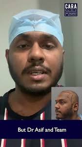 CARA Hair Transplant Testimonial [Patient From Auckland]