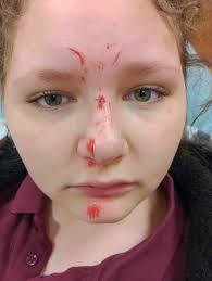 Chicago snowstorms and roof shoveling experiences