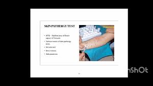 Image result for Pathergy