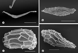 Image result for Platycoryne crocea