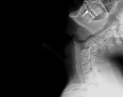 نتیجه جستجوی لغت [injure] در گوگل