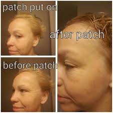 What is the difference between beauty patches?