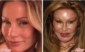 This is a better and more updated version of my other jocelyn wildenstein video. Get To Know The Socialite Jocelyn Wildenstein Before Her Disastrous Plastic Surgery Complete Story Here Glamour Fame