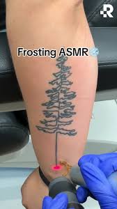 The World's Tattoo Removal Experts