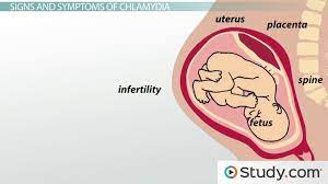 Candida yeast cause an infection when something throws off the balance of microorganisms that live in and on your body, such as understanding yeast infection causes can help you lower your risk. What Is Chlamydia Trachomatis Symptoms Signs Treatment Video Lesson Transcript Study Com