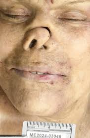 🔸Unidentified Person