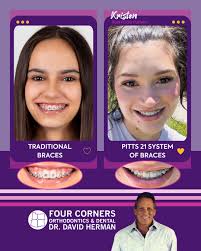 I love my new smile because it looks good for my sports pictures. Everyone  at Dr. Herman's office is nice and friendly!" -Abel Abel is from  Bloomfield, New Mexico and plays football