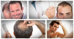 How To Naturally Regrow Lost Hair In 15 Minutes A Day Pdf Review