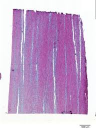 Image result for Dalbergia nitidula