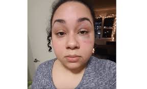 Let's talk about those damn bus doors again