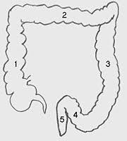 The term right colon is hypernymous to ascending colon in precise use; Darmkarzinom