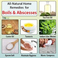 Boils And Abscesses All Natural Home Remedies Top 10 Home Remedies Natural Home Remedies Home Remedies Home Remedy For Boils