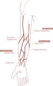 Superficial and deep anterior muscles of upper body Getting Off The Basics Of Safer Injection Harm Reduction Coalition