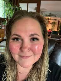 Skincare Product Reviews and Experiences