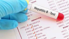 Hepatitis b is a serious liver infection caused by the hepatitis b virus (hbv). Hepatitis B And Your Cancer Risk Md Anderson Cancer Center