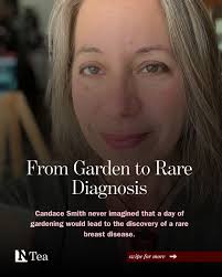 She thought it was just a day of gardening 🌱 but a painful lump led Candace  Smith to a diagnosis she never expected. Granulomatous mastitis is a rare,  non-cancerous breast disease that