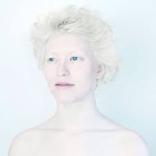 Just mention those two words around a campfire or any gathering of hunters and you are sure to get some piebald deer can have white patches of hair but otherwise is colored normally. 58 Albino People Who Ll Mesmerize You With Their Beauty Bored Panda