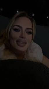 #plasticsurgerytiktoks #biglipsfilter #funnyfaceeffects #funnylips