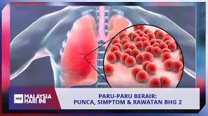 Paru Paru Berair Punca Simptom Rawatan Bhg 2 Mhi 12 November 2019 Youtube