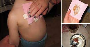 O bomboana de menta poate ajuta, de asemenea, la eliminarea congestiei in piept si sinusuri. Ghimbirul Te AjutÄƒ SÄƒ Scapi Imediat De Mucusul Din PlÄƒmani IatÄƒ Cum Trebuie Folosit