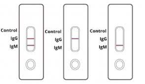 Ist das coronavirus anfänglich eher im rachenraum zu finden, siedelt es sich im weiteren verlauf der erkrankung. Covid 19 Antibody Rapid Test Kit Coronavirus Igm Igg Antibody Test