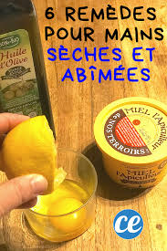 6 Remedes De Grand Mere Pour Dire Adieu Aux Mains Seches Et Abimees En 2020 Soin Des Ongles Mains Seches Remede De Grand Mere