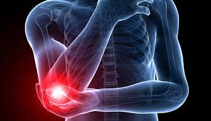 Tenisci Dirsegi Doc Dr Aydin Arslan