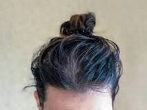 Image result
