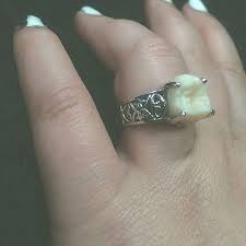 This Woman S Engagement Ring Is Her Fiance S Wisdom Tooth Teeth Jewelry Tooth Ring Womens Engagement Rings