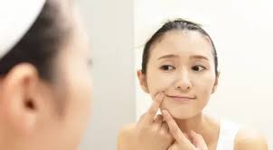 15 Cara Menghilangkan Bekas Jerawat Dengan Cepat Dan Mudah Dalam 1 Hari Secara Alami Beauty Fimela Com