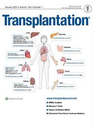Image result for Transplantation